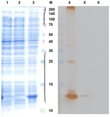 Preparation of MS2 Phage-Like Particles and Their Use As Potential Process Control Viruses for Detection and Quantification of Enteric RNA Viruses in Different Matrices